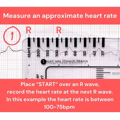 ECG 7 Step Ruler, ECG Ruler Plastic Ruler Measuring Tool, ECG 7 Step Ruler for ECG/EKG Interpretation, Transparent ECG Calipers Measuring Tool, Easy to Carry ECG Ruler, Follow 7 Step Plan (1pc)