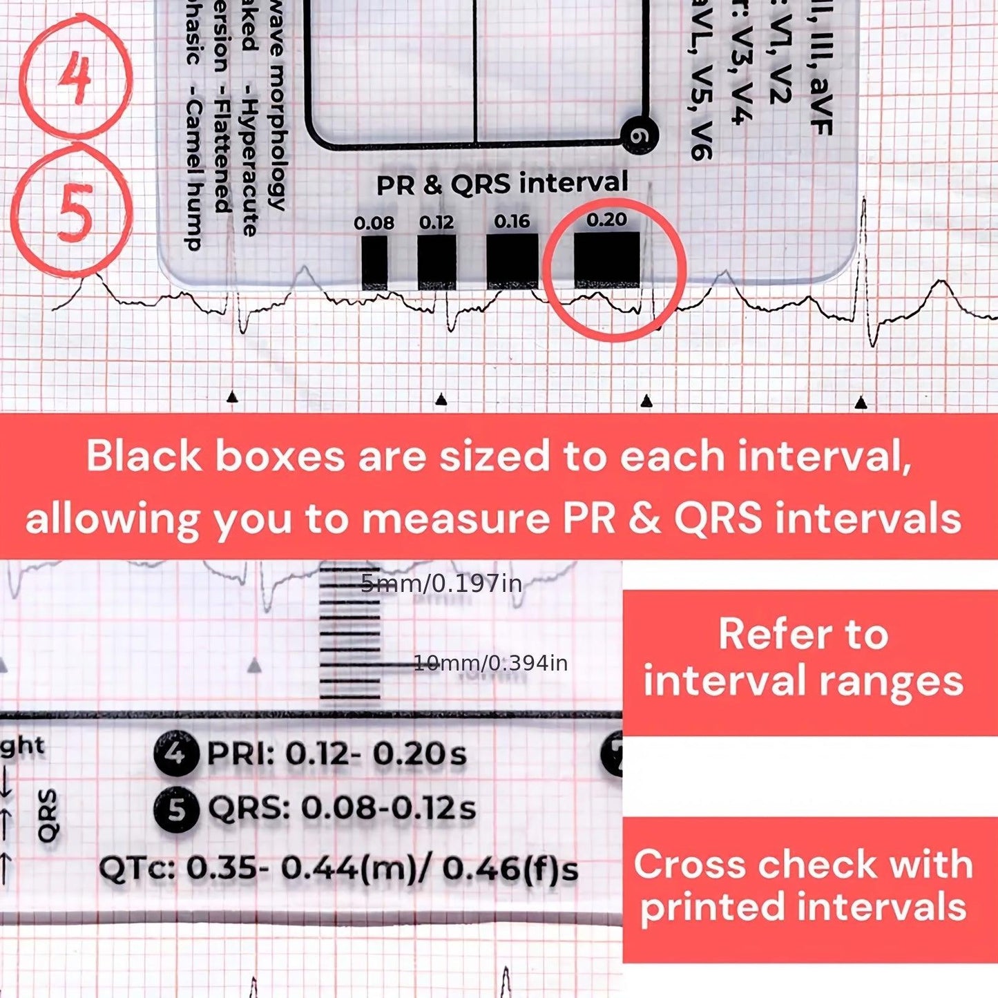 ECG 7 Step Ruler, ECG Ruler Plastic Ruler Measuring Tool, ECG 7 Step Ruler for ECG/EKG Interpretation, Transparent ECG Calipers Measuring Tool, Easy to Carry ECG Ruler, Follow 7 Step Plan (1pc)