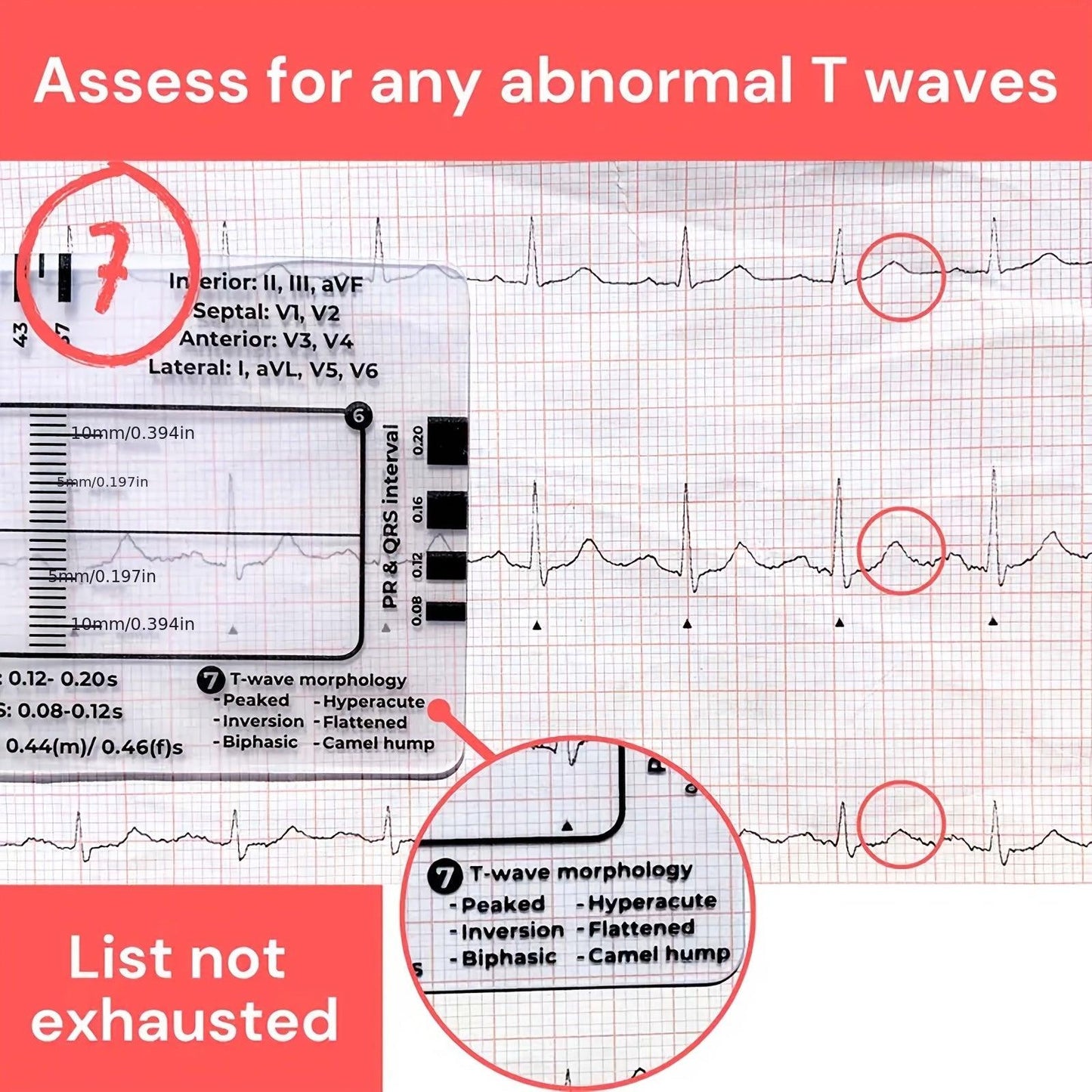 ECG 7 Step Ruler, ECG Ruler Plastic Ruler Measuring Tool, ECG 7 Step Ruler for ECG/EKG Interpretation, Transparent ECG Calipers Measuring Tool, Easy to Carry ECG Ruler, Follow 7 Step Plan (1pc)