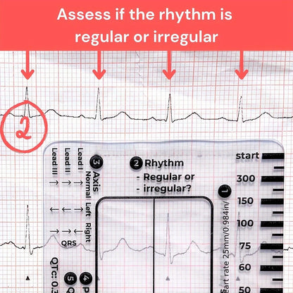 ECG 7 Step Ruler, ECG Ruler Plastic Ruler Measuring Tool, ECG 7 Step Ruler for ECG/EKG Interpretation, Transparent ECG Calipers Measuring Tool, Easy to Carry ECG Ruler, Follow 7 Step Plan (1pc)