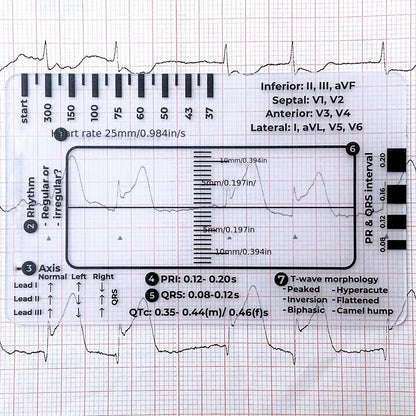 ECG 7 Step Ruler, ECG Ruler Plastic Ruler Measuring Tool, ECG 7 Step Ruler for ECG/EKG Interpretation, Transparent ECG Calipers Measuring Tool, Easy to Carry ECG Ruler, Follow 7 Step Plan (1pc)