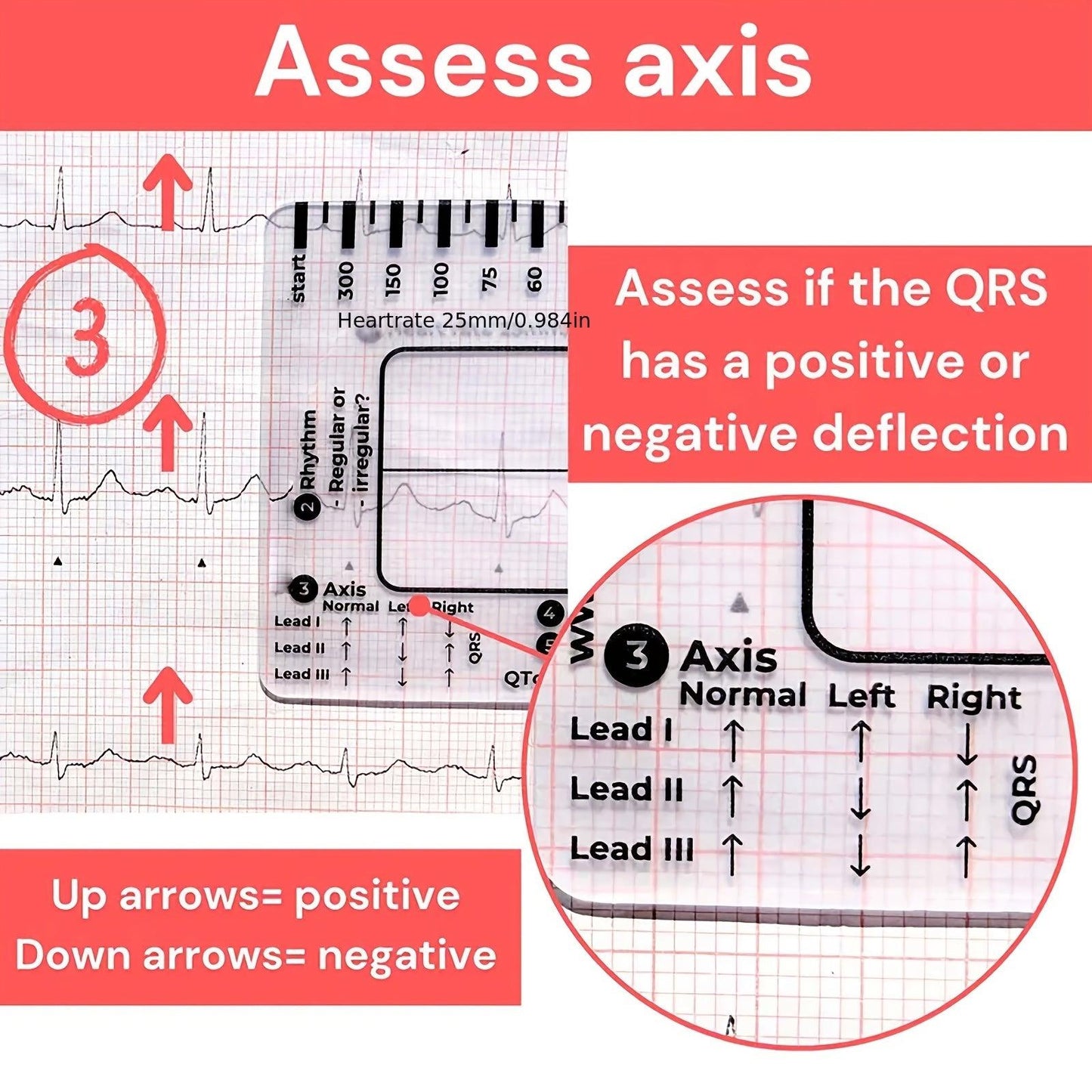 ECG 7 Step Ruler, ECG Ruler Plastic Ruler Measuring Tool, ECG 7 Step Ruler for ECG/EKG Interpretation, Transparent ECG Calipers Measuring Tool, Easy to Carry ECG Ruler, Follow 7 Step Plan (1pc)